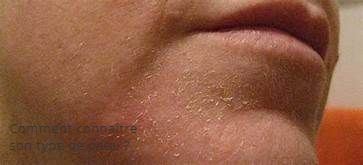 Comment connaître son type de peau ?  