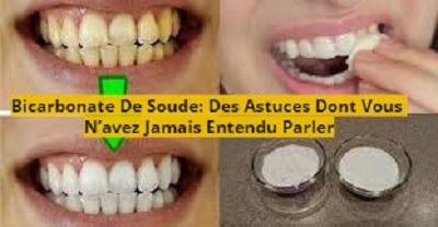 Bicarbonate De Soude: Des Astuces Dont Vous N’avez Jamais Entendu Parler