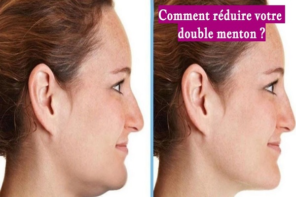 Comment réduire votre double menton ?