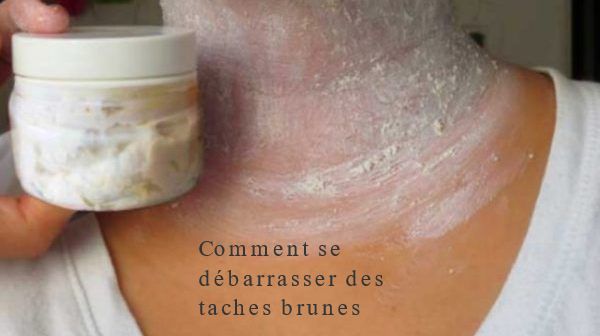 Comment se débarrasser des taches brunes