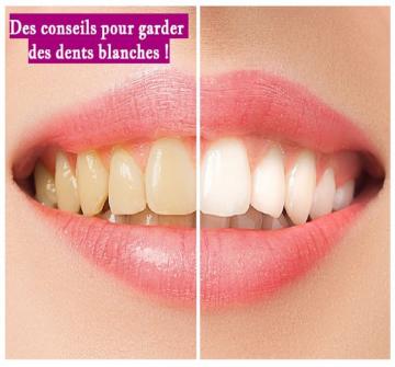 Nos dents n’ont pas besoin d’être aussi blanches qu’elles brillent dans le noir, mais nous préférons avoir des dents qui ne sont pas décolorées.
