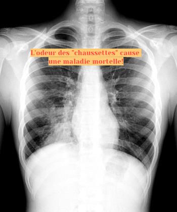 L'odeur des chaussettes L'odeur des "chaussettes" cause une maladie mortelle!