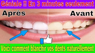 L'astuce la plus facile et efficace pour blanchir des dents
