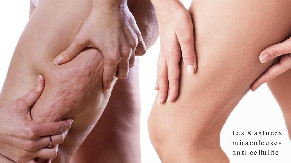 Les 8 astuces miraculeuses anti-cellulite