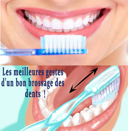 Les meilleures gestes d'un bon brossage des dents !