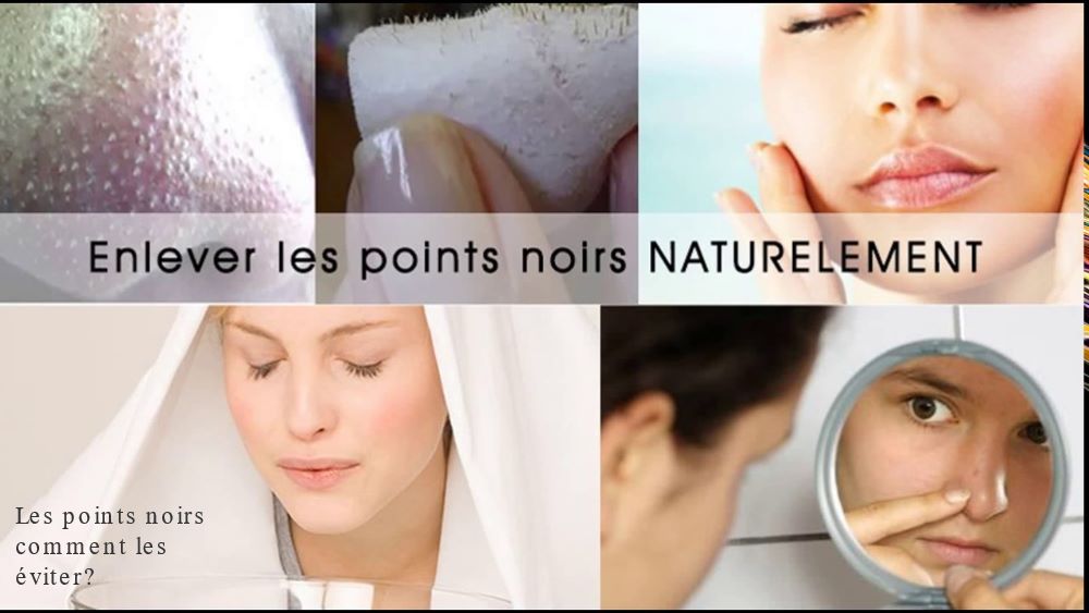 Les points noirs comment les éviter?