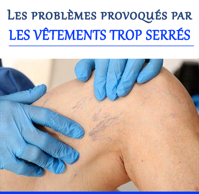 Les problèmes provoqués par les vêtements trop serrés 