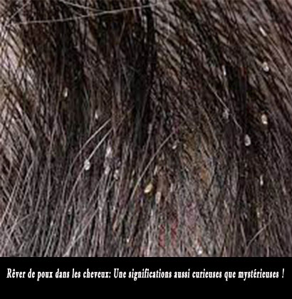 Rêver de poux dans les cheveux: Une significations aussi curieuses que mystérieuses !