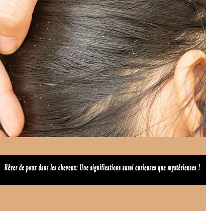 Rêver de poux dans les cheveux: Une significations aussi curieuses que mystérieuses !