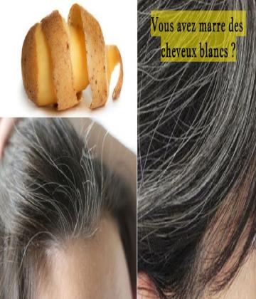 Certaines personnes ont leurs premiers cheveux blancs dès le début de la vingtaine, alors que d’autres n’en ont pas pendant très longtemps.