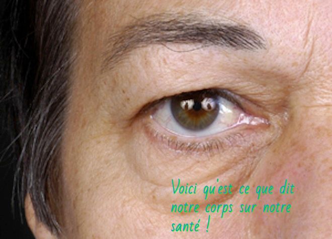 Des yeux gonflés Voici qu'est ce que dit notre corps sur notre santé