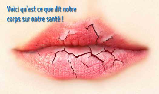 Des lèvres sèches Voici qu'est ce que dit notre corps sur notre santé