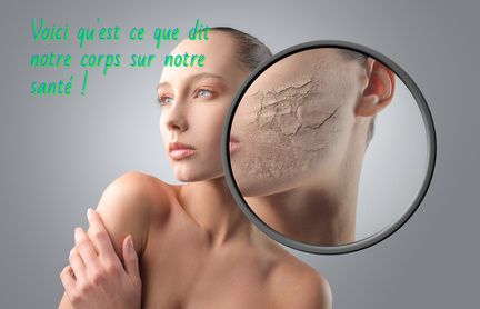Une peau déshydratée Voici qu'est ce que dit notre corps sur notre santé