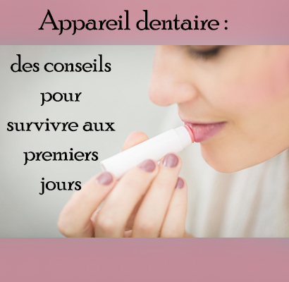 Appareil dentaire : des conseils pour survivre aux premiers jours