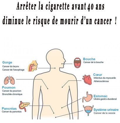 Arrêter la cigarette avant 40 ans diminue le risque de mourir d’un cancer !