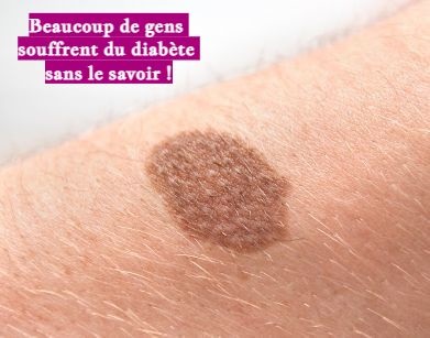 Beaucoup de gens souffrent du diabète sans le savoir !