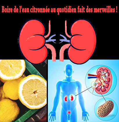 Boire de l'eau citronnée au quotidien fait des merveilles !