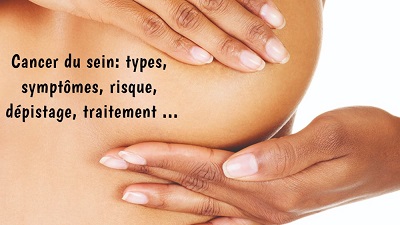 Cancer du sein: types, symptômes, risque, dépistage, traitement …