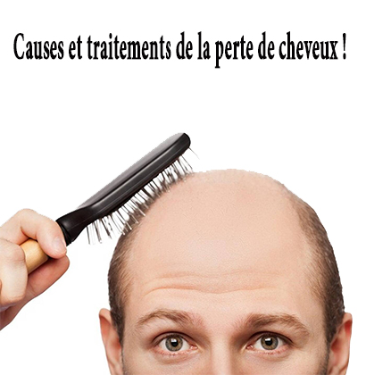 Causes et traitements de la perte de cheveux ! Causes et traitements de la perte de cheveux !