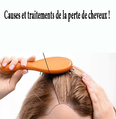 Causes et traitements de la perte de cheveux ! Causes et traitements de la perte de cheveux !