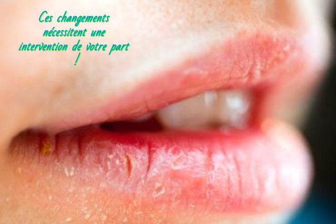 Ces changements nécessitent une intervention Ces changements nécessitent une intervention de votre part