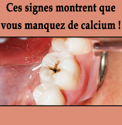 Ces signes montrent que vous manquez de calcium !