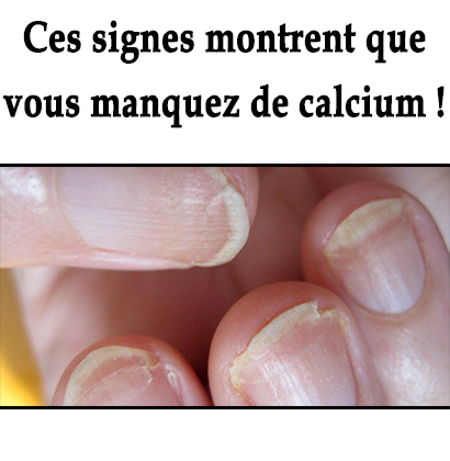Ces signes montrent que vous manquez de calcium !