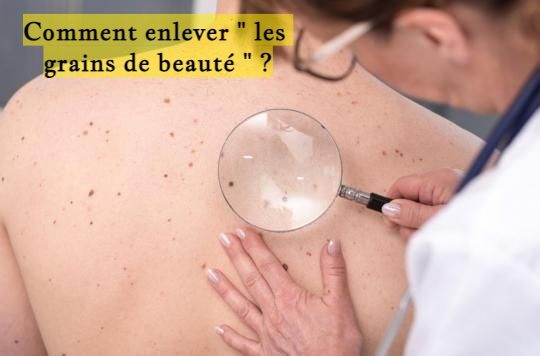 Comment enlever " les grains de beauté " ?
