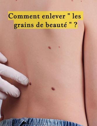 Comment enlever " les grains de beauté " ?
