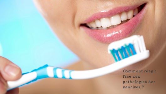 Comment réagir face aux pathologies des gencives ?