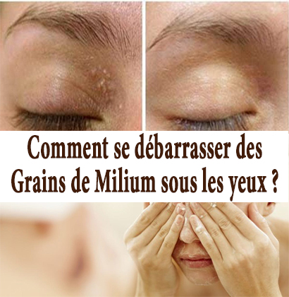 Comment se débarrasser des Grains de Milium sous les yeux ? 