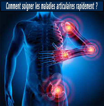 Comment soigner les maladies articulaires rapidement ? Comment soigner les maladies articulaires rapidement ?