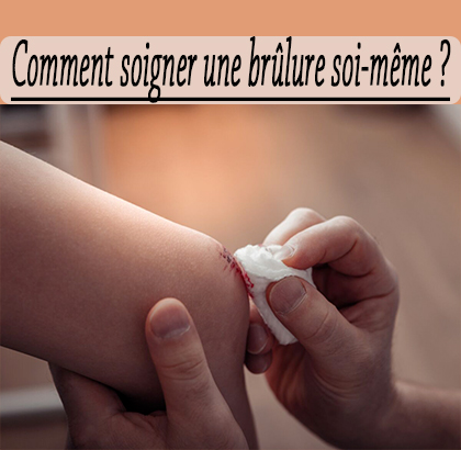 Comment soigner une brûlure soi-même ?