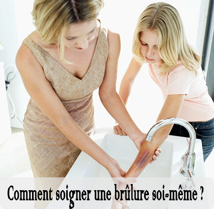 Comment soigner une brûlure soi-même ?