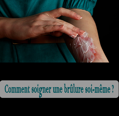 Comment soigner une brûlure soi-même ?