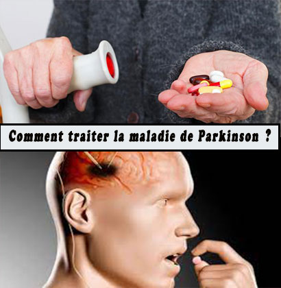 Comment traiter la maladie de Parkinson ?