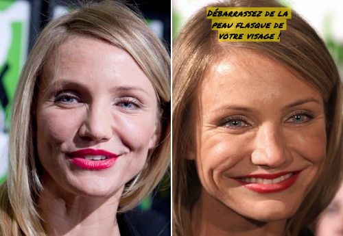 Débarrassez de la peau flasque de votre visage