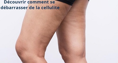 Découvrir comment se débarrasser de la cellulite