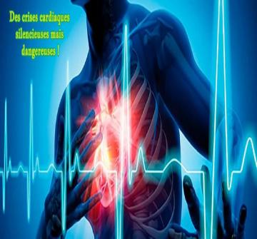 La moitié des crises cardiaques serait silencieuse. Des infarctus qui passeraient inaperçus, mais qui pourraient être extrêmement dangereux.