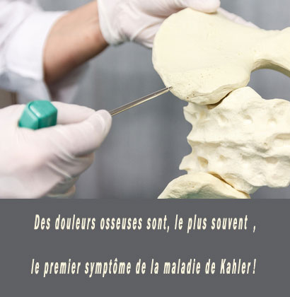 Des douleurs osseuses sont, le plus souvent, le premier symptôme de la maladie de Kahler ! Des douleurs osseuses sont, le plus souvent, le premier symptôme de la maladie de Kahler !