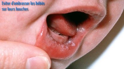 Eviter d'embrasser les bébés sur leurs bouches!