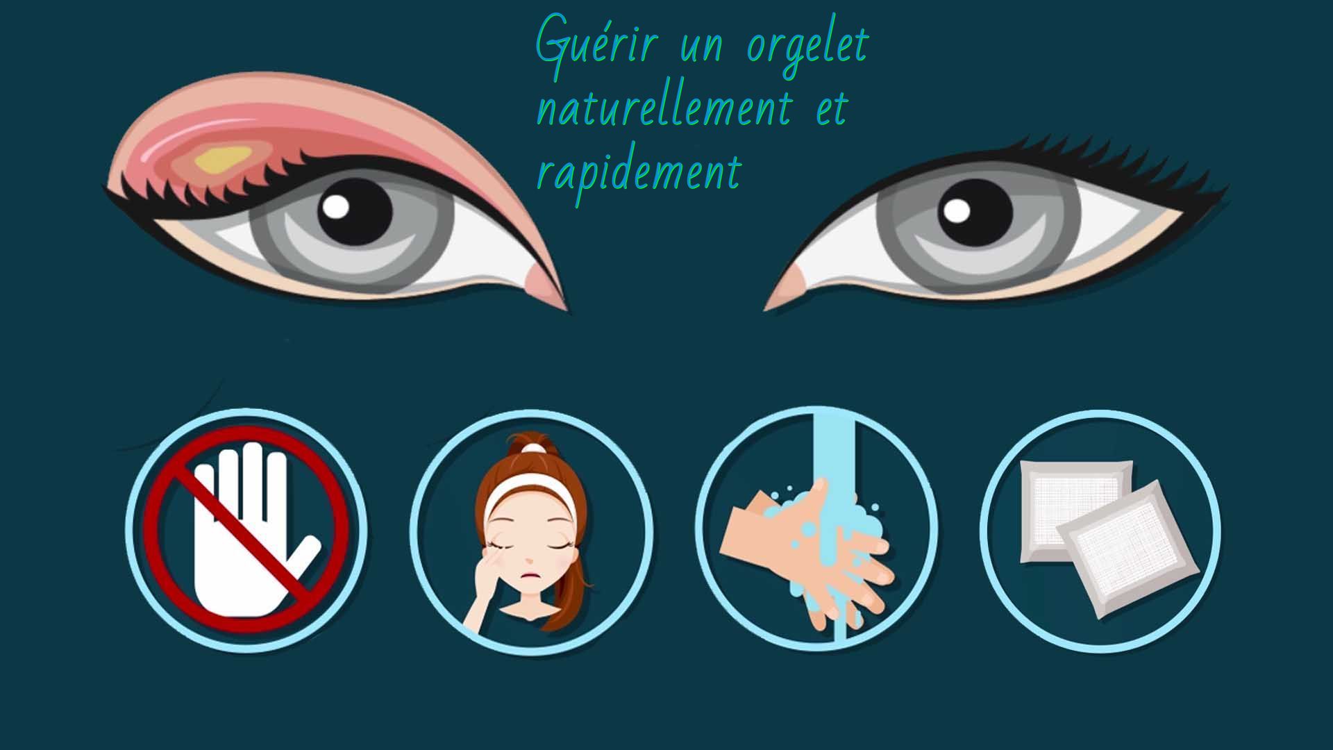 Guérir un orgelet naturellement et rapidement