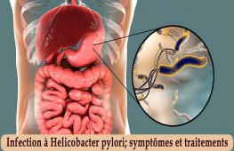 Saviez-vous l’Helicobacter pylori est responsable de l’infection bactérienne chronique la plus répandue ? Environ 20 à 25 % de la population serait porteuse de ce germe en France et 50 % dans le monde entier. C’est peut-être une explication si vous souffrez de maux gastriques régulièrement. 