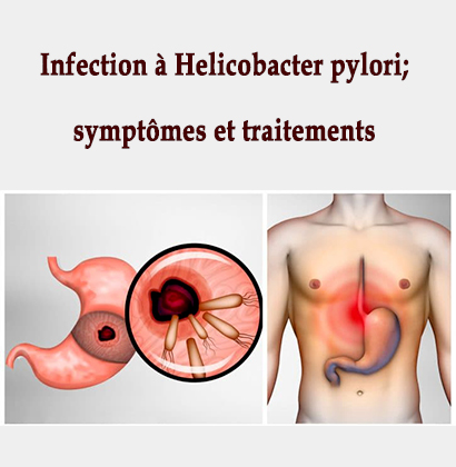 Infection à Helicobacter pylori; symptômes et traitements 