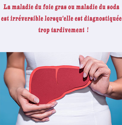 La maladie du foie gras ou maladie du soda est irréversible lorsqu'elle est diagnostiquée trop tardivement ! La maladie du foie gras ou maladie du soda est irréversible lorsqu'elle est diagnostiquée trop tardivement !