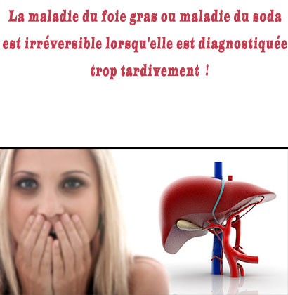 La maladie du foie gras ou maladie du soda est irréversible lorsqu'elle est diagnostiquée trop tardivement ! La maladie du foie gras ou maladie du soda est irréversible lorsqu'elle est diagnostiquée trop tardivement !