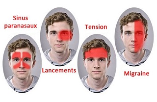 la migraine quelle est la cause et le traitement possible?