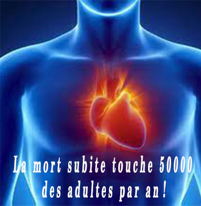 La mort subite touche 50000 des adultes par an !