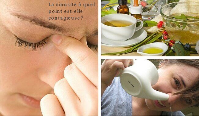 La sinusite à quel point est-elle contagieuse?