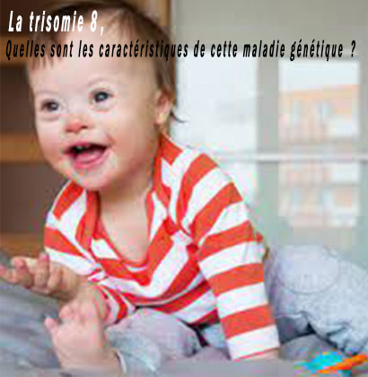 La trisomie 8, Quelles sont les caractéristiques de cette maladie génétique ?